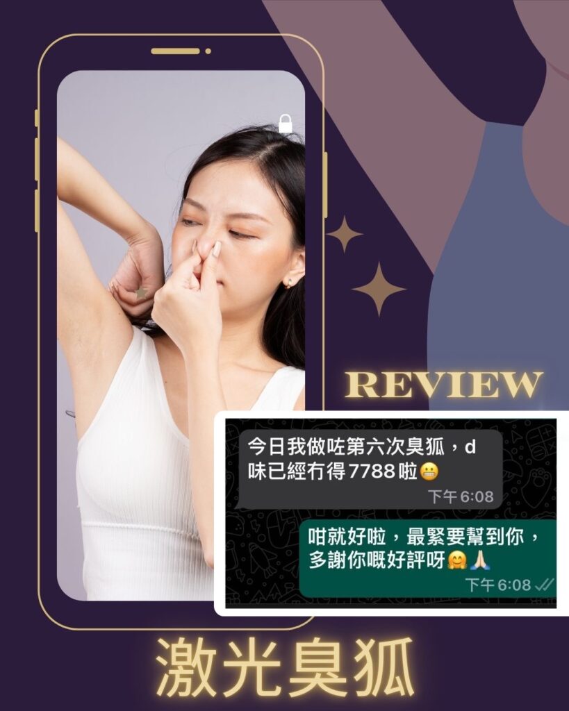 激光除臭狐